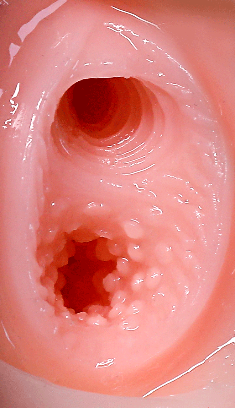 Six Sensations Six-Channel Textured Masturbator